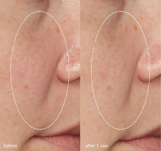 Liquid Peelfoliant