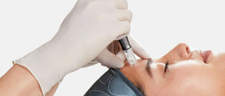 Treatment Spotlight: PRO Microneedling!