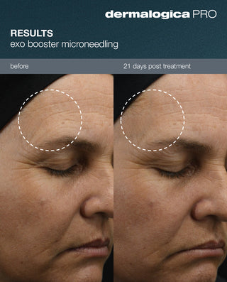 Skin Revival Package