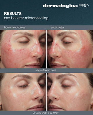 Skin Revival Package